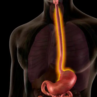 atención a tracto gastrointestinal en oaxaca