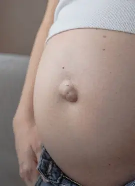 cuando tratar la hernia umbilical Cirugía de Hernia Umbilical en Oaxaca